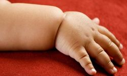 Obesitas pada Anak Balita, Apakah Perlu Diet?